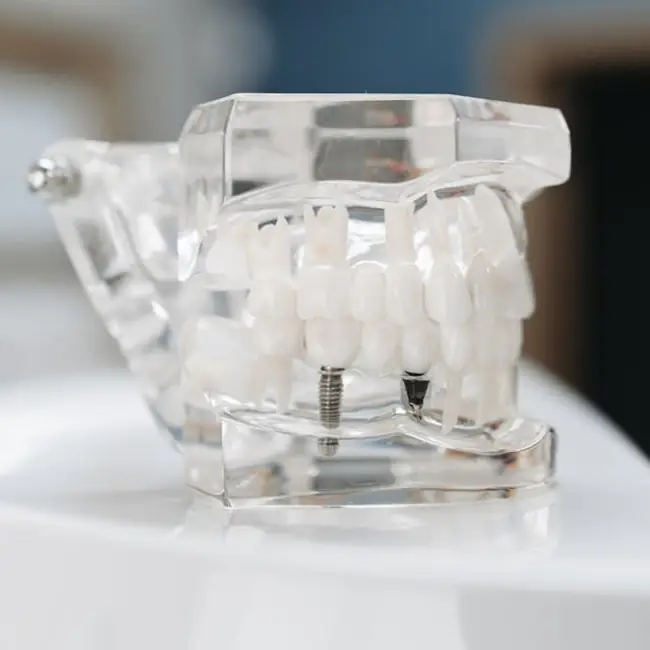 Dental implant restoration image for missing tooth replacement in Peculiar Missouri